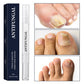 ✨New Arrivals🔥Toenail Fungus Treatment Pen for Damaged Nails